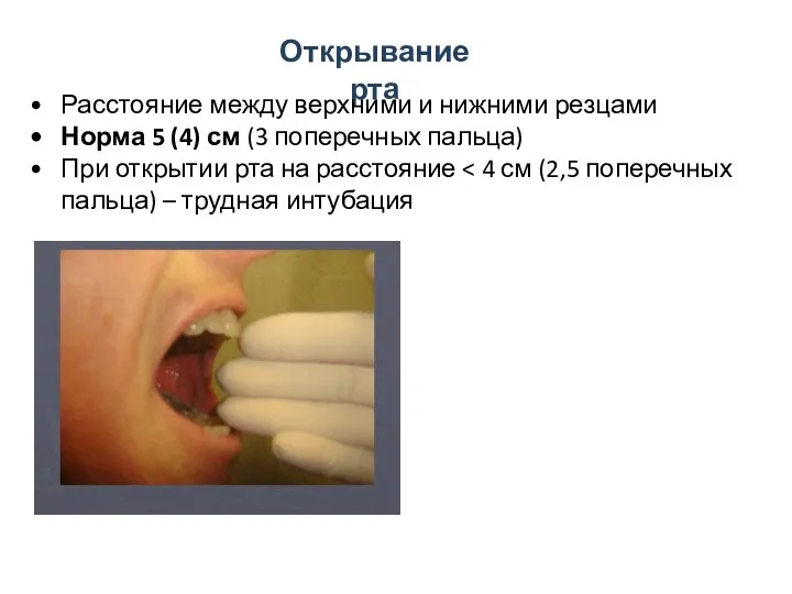 Открывание рта Расстояние между верхними и нижними резцами Норма 5 (4) см