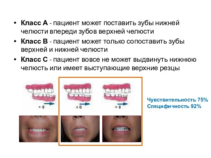 Класс А - пациент может поставить зубы нижней челюсти впереди зубов верхней