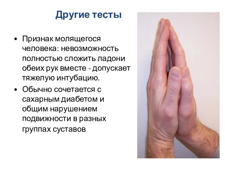 Другие тесты Признак молящегося человека: невозможность полностью сложить ладони обеих рук вместе