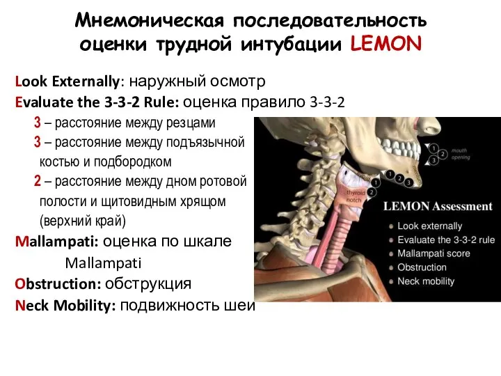 Мнемоническая последовательность оценки трудной интубации LEMON Look Externally: наружный осмотр Evaluate the