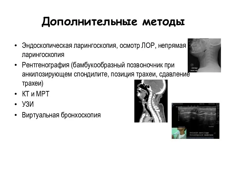 Дополнительные методы Эндоскопическая ларингоскопия, осмотр ЛОР, непрямая ларингоскопия Рентгенография (бамбукообразный позвоночник при