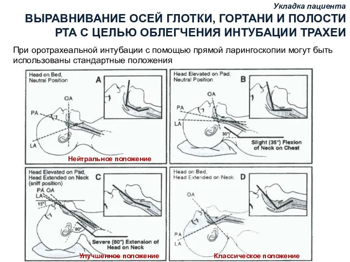 Укладка пациента Укладка пациента ВЫРАВНИВАНИЕ ОСЕЙ ГЛОТКИ, ГОРТАНИ И ПОЛОСТИ РТА С