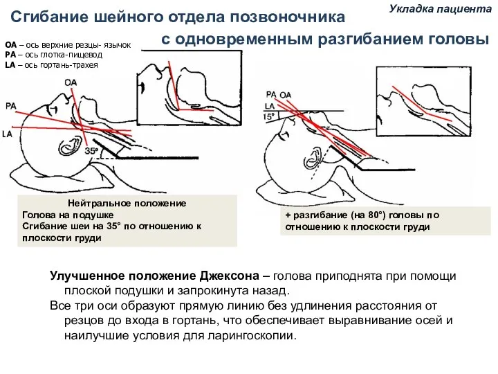 Сгибание шейного отдела позвоночника ОА – ось верхние резцы- язычок РА –