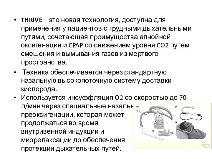 THRIVE – это новая технология, доступна для применения у пациентов с трудными