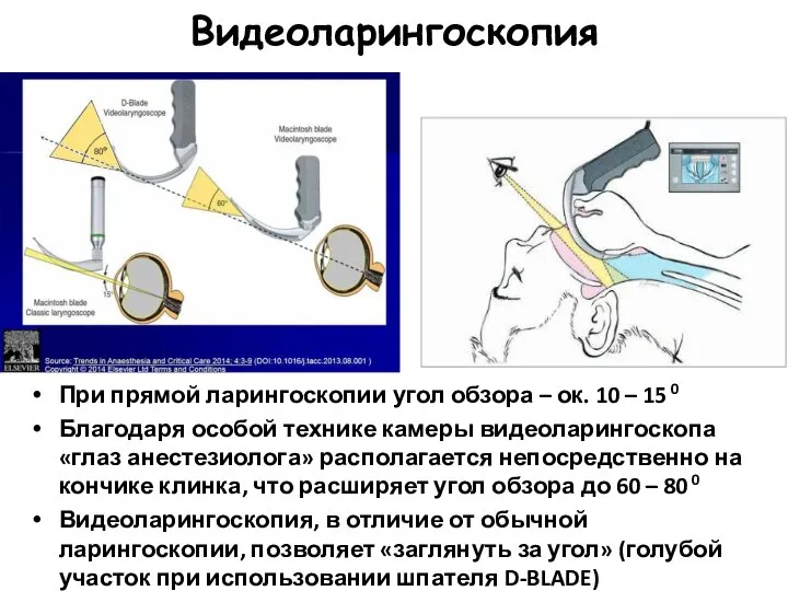 Видеоларингоскопия При прямой ларингоскопии угол обзора – ок. 10 – 15 0