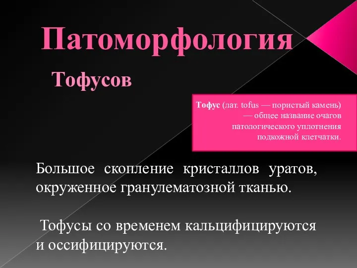 Патоморфология Тофусов Тофус (лат. tofus — пористый камень) — общее название очагов