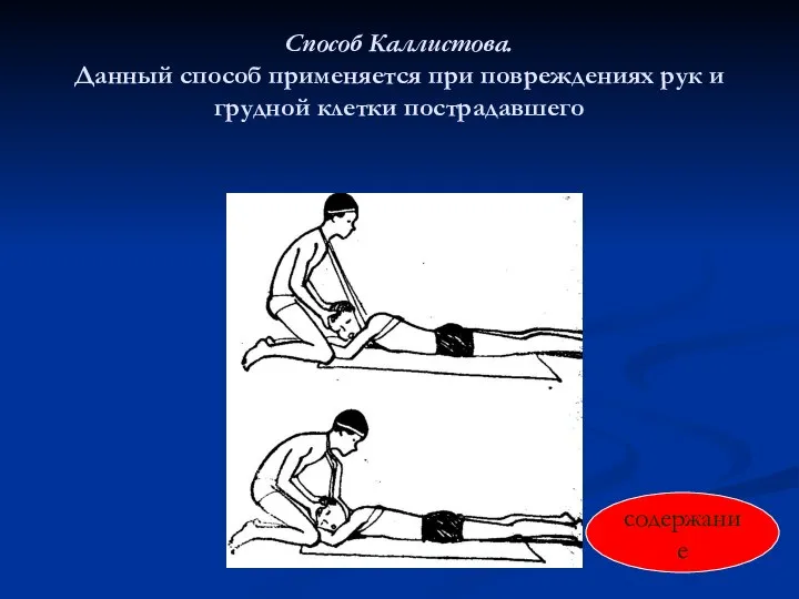 Способ Каллистова. Данный способ применяется при повреждениях рук и грудной клетки пострадавшего содержание