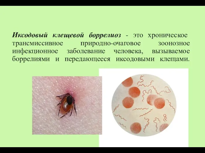 Иксодовый клещевой боррелиоз - это хроническое трансмиссивное природно-очаговое зоонозное инфекционное заболевание человека,