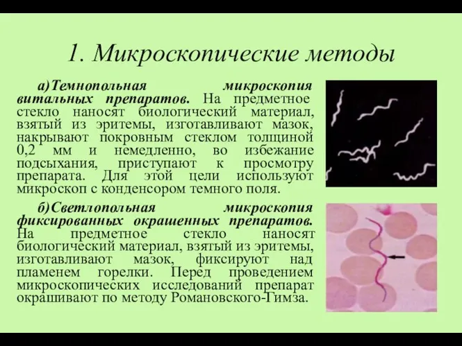 1. Микроскопические методы а)Темнопольная микроскопия витальных препаратов. На предметное стекло наносят биологический