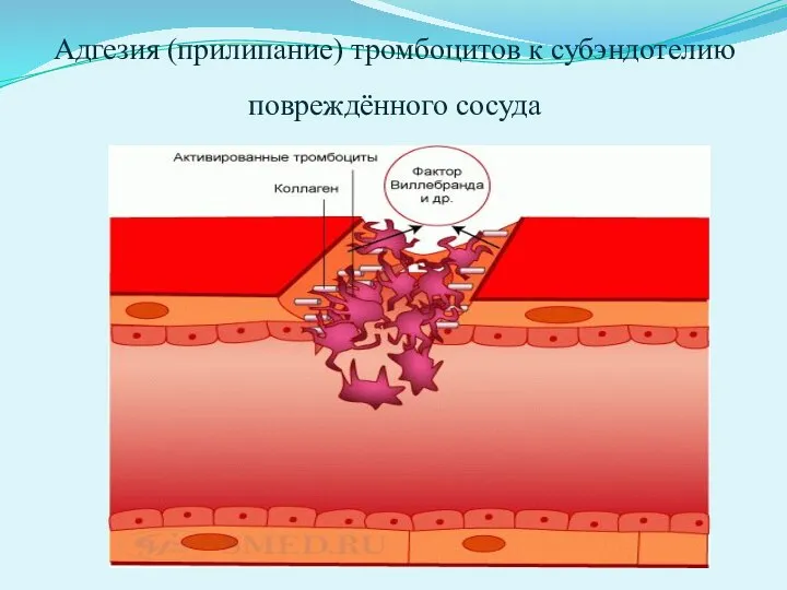 Адгезия (прилипание) тромбоцитов к субэндотелию повреждённого сосуда