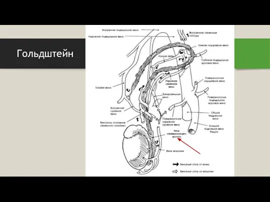 Гольдштейн