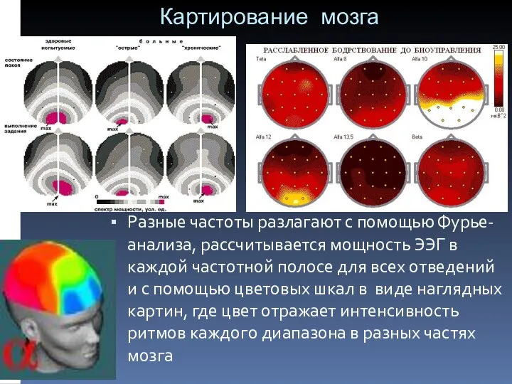 Картирование мозга Разные частоты разлагают с помощью Фурье-анализа, рассчитывается мощность ЭЭГ в