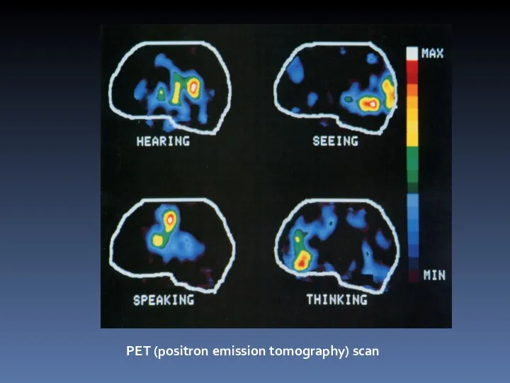 PET (positron emission tomography) scan