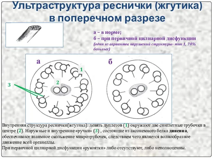 Ультраструктура реснички (жгутика) в поперечном разрезе Внутренняя структура реснички(жгутика): девять дуплетов (1)