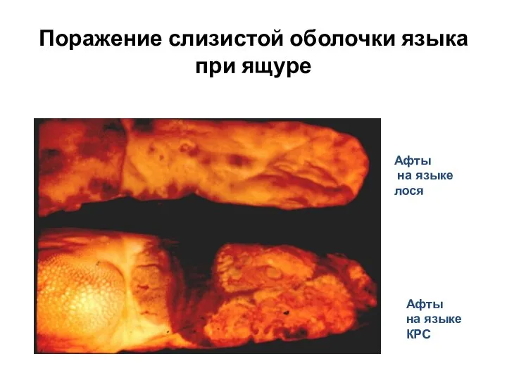 Поражение слизистой оболочки языка при ящуре Афты на языке лося Афты на языке КРС