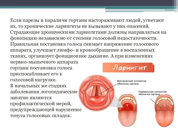 Если парезы и параличи гортани настораживают людей, угнетают их, то хронические ларингиты