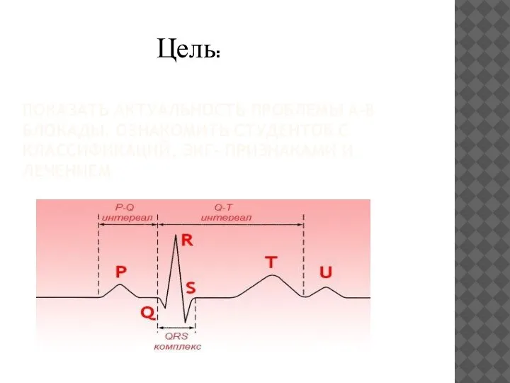 ПОКАЗАТЬ АКТУАЛЬНОСТЬ ПРОБЛЕМЫ А-В БЛОКАДЫ. ОЗНАКОМИТЬ СТУДЕНТОВ С КЛАССИФИКАЦИЙ, ЭКГ- ПРИЗНАКАМИ И ЛЕЧЕНИЕМ Цель: