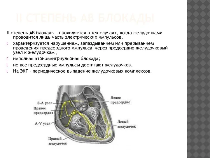 II СТЕПЕНЬ АВ БЛОКАДЫ II степень АВ блокады –проявляется в тех случаях,