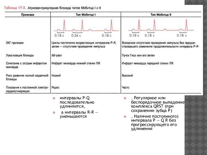 интервалы P-Q последовательно удлиняются, а интервалы R-R — уменьшаются . Регулярное или