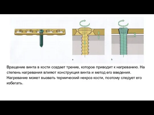 Вращение винта в кости создает трение, которое приводит к нагреванию. На степень