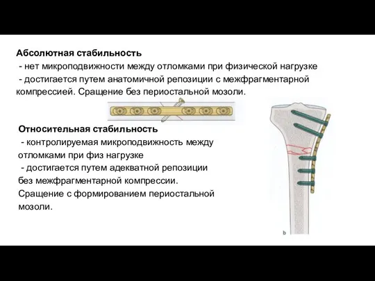 Абсолютная стабильность - нет микроподвижности между отломками при физической нагрузке - достигается