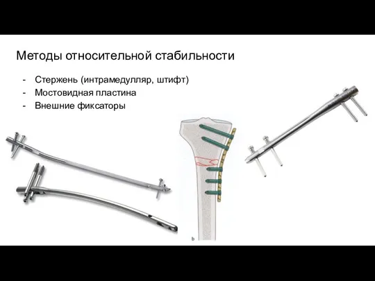 Методы относительной стабильности Стержень (интрамедулляр, штифт) Мостовидная пластина Внешние фиксаторы