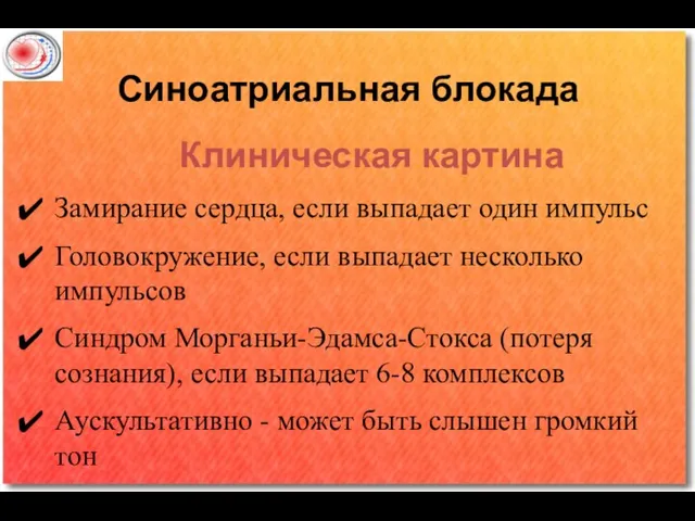 Синоатриальная блокада Клиническая картина Замирание сердца, если выпадает один импульс Головокружение, если