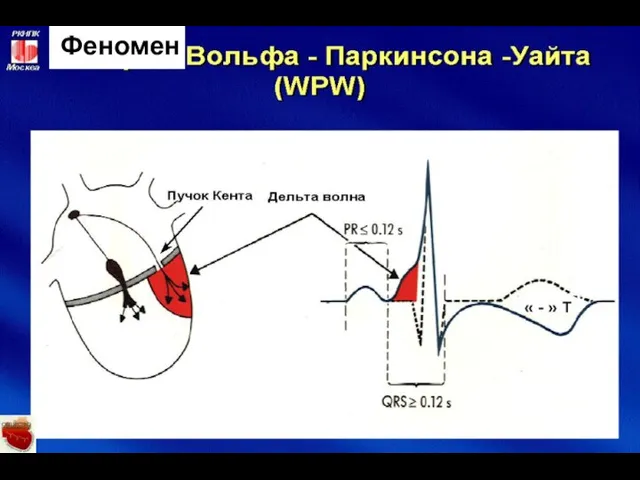 Феномен