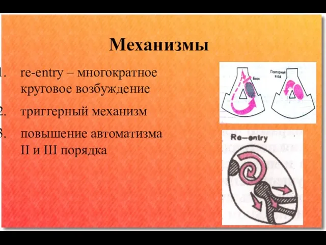 Механизмы re-entry – многократное круговое возбуждение триггерный механизм повышение автоматизма II и III порядка