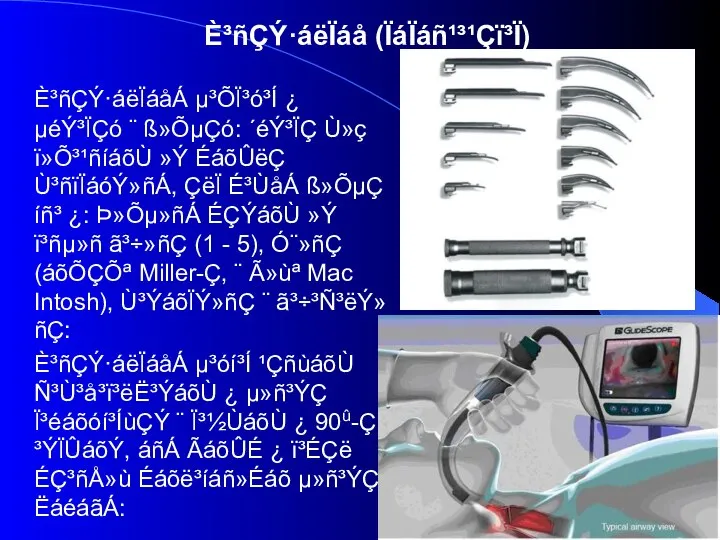 È³ñÇÝ·áëÏáåÁ µ³ÕÏ³ó³Í ¿ µéÝ³ÏÇó ¨ ß»ÕµÇó: ´éÝ³ÏÇ Ù»ç ï»Õ³¹ñíáõÙ »Ý ÉáõÛëÇ Ù³ñïÏáóÝ»ñÁ,