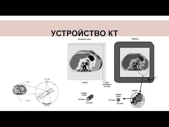 УСТРОЙСТВО КТ