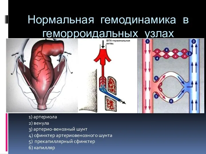 Нормальная гемодинамика в геморроидальных узлах 1) артериола 2) венула 3) артерио-венозный шунт