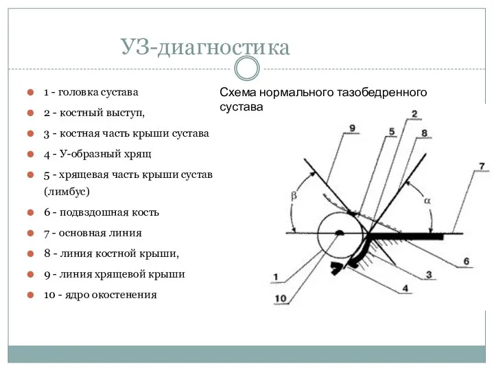 1 - головка сустава 2 - костный выступ, 3 - костная часть