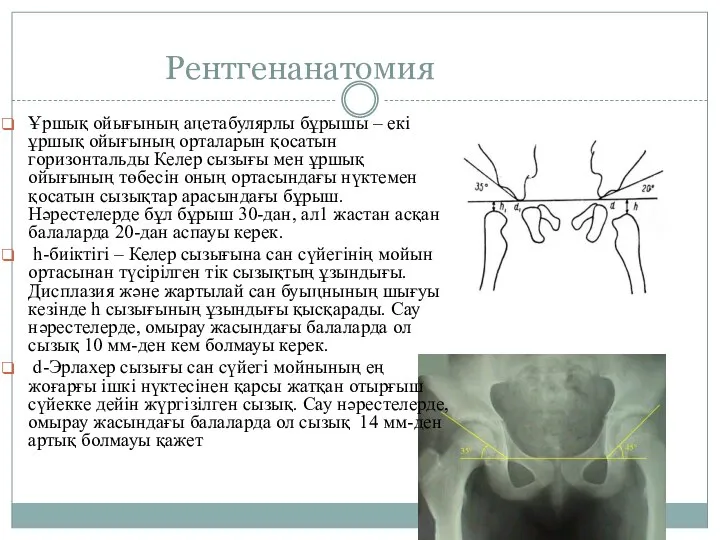 Рентгенанатомия Ұршық ойығының ацетабулярлы бұрышы – екі ұршық ойығының орталарын қосатын горизонтальды