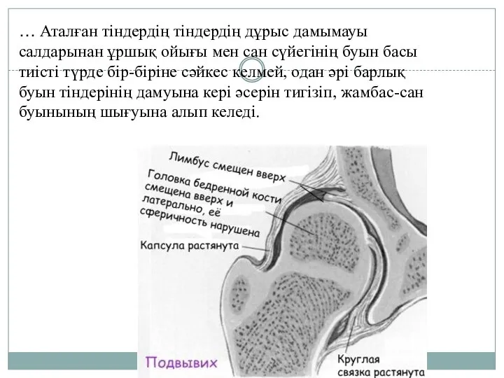 … Аталған тіндердің тіндердің дұрыс дамымауы салдарынан ұршық ойығы мен сан сүйегінің