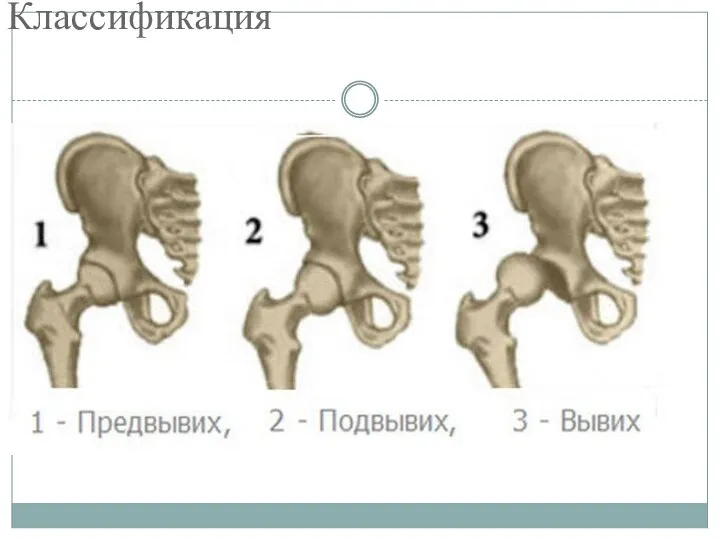 Классификация