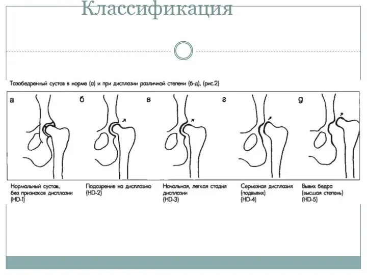 Классификация