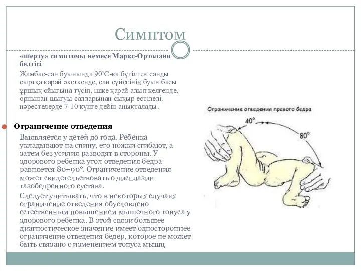 Симптом «шерту» симптомы немесе Маркс-Ортолани белгісі Жамбас-сан буынында 90’C-қа бүгілген санды сыртқа