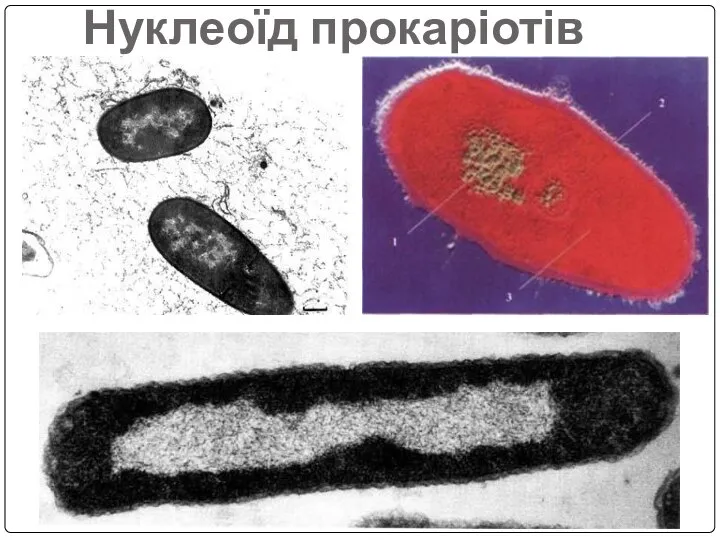 Нуклеоїд прокаріотів