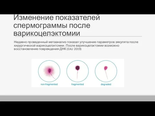 Изменение показателей спермограммы после варикоцелэктомии Недавно проведенный метаанализ показал улучшение параметров эякулята