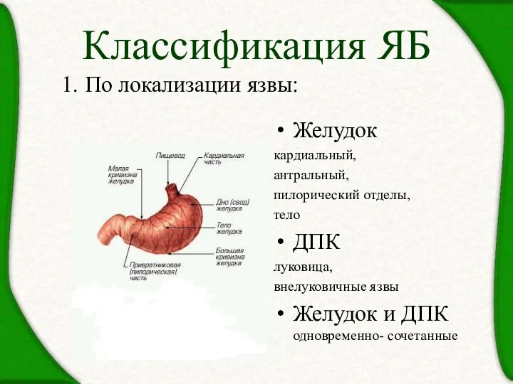Классификация ЯБ Желудок кардиальный, антральный, пилорический отделы, тело ДПК луковица, внелуковичные язвы