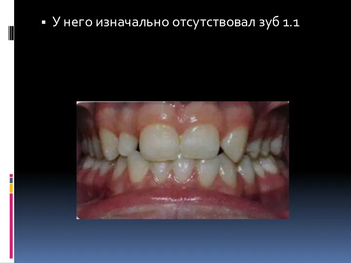 У него изначально отсутствовал зуб 1.1