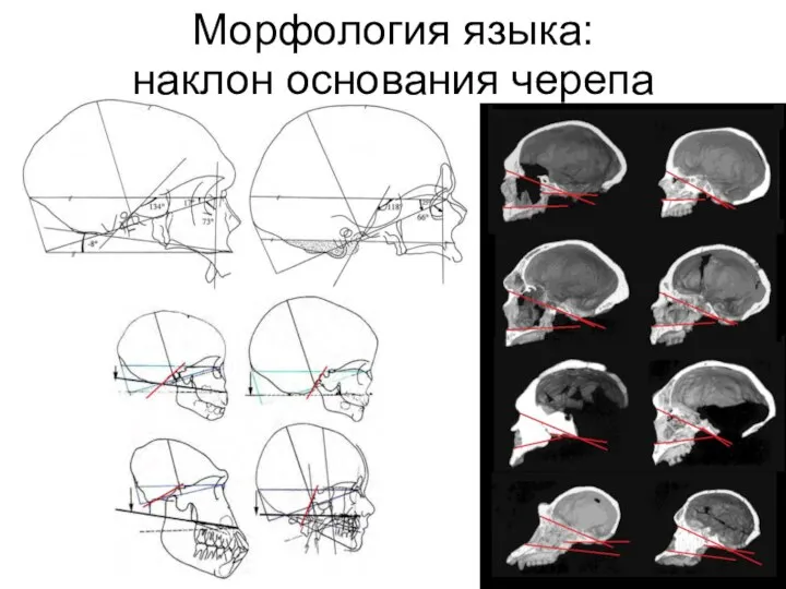 Морфология языка: наклон основания черепа