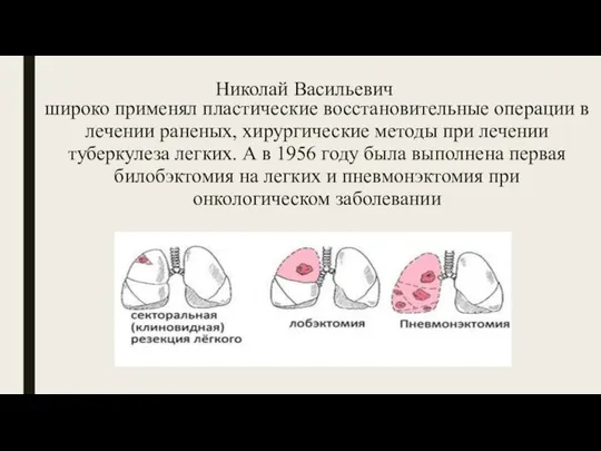 Николай Васильевич широко применял пластические восстановительные операции в лечении раненых, хирургические методы