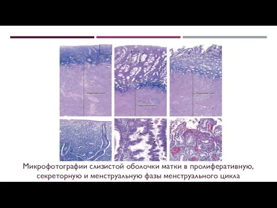 Микрофотографии слизистой оболочки матки в пролиферативную, секреторную и менструальную фазы менструального цикла