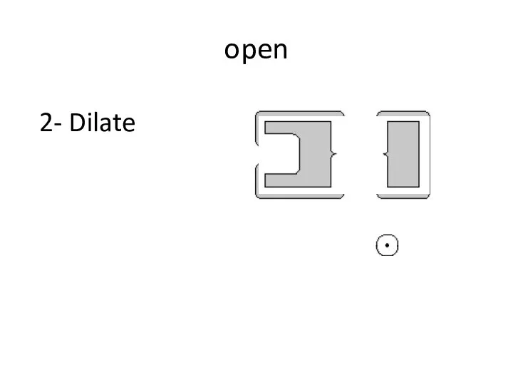 open 2- Dilate