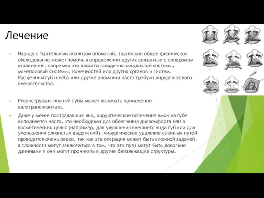 Лечение Наряду с тщательным анализом аномалий, тщательно общее физическое обследование может помочь