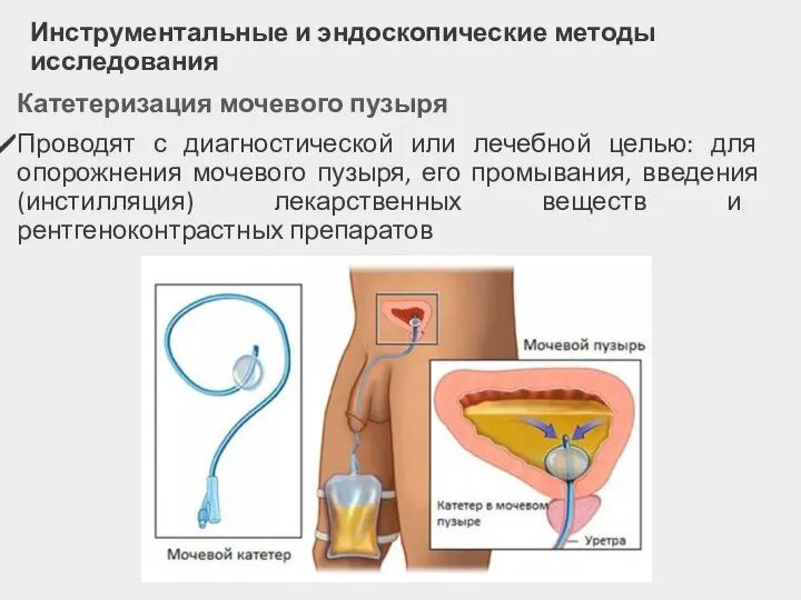 Инструментальные и эндоскопические методы исследования Катетеризация мочевого пузыря Проводят с диагностической или