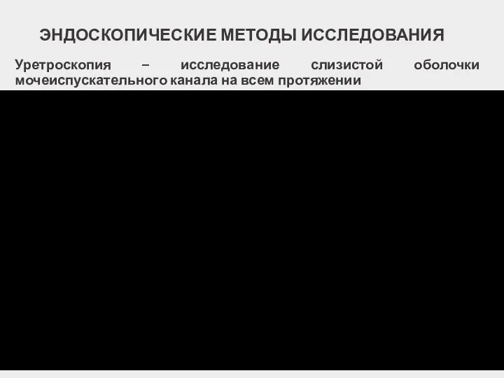 ЭНДОСКОПИЧЕСКИЕ МЕТОДЫ ИССЛЕДОВАНИЯ Уретроскопия – исследование слизистой оболочки мочеиспускательного канала на всем протяжении