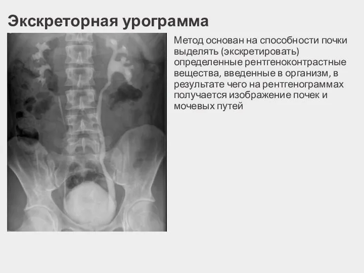 Экскреторная урограмма Метод основан на способности почки выделять (экскретировать) определенные рентгеноконтрастные вещества,